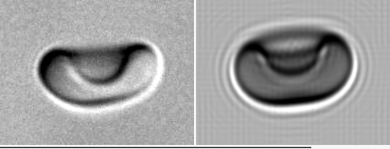 Stomatocyte